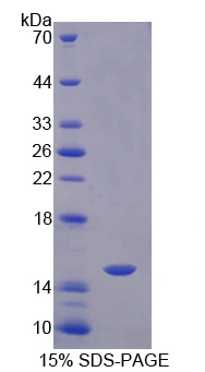 SDS-PAGE analysis of GTX04106-pro Human caspase 8 protein, His and T7 Tag. SDS-PAGE analysis of GTX04106-pro Human caspase 8 protein, His and T7 Tag.