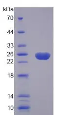SDS-PAGE analysis of GTX04107-pro Human caspase 8 protein, His tag. SDS-PAGE analysis of GTX04107-pro Human caspase 8 protein, His tag.
