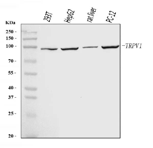 WB analysis of various sample lysates using GTX04108 VR1/ TRPV1 antibody. Loading : 30 microg Dilution : 0.5 microg/mL