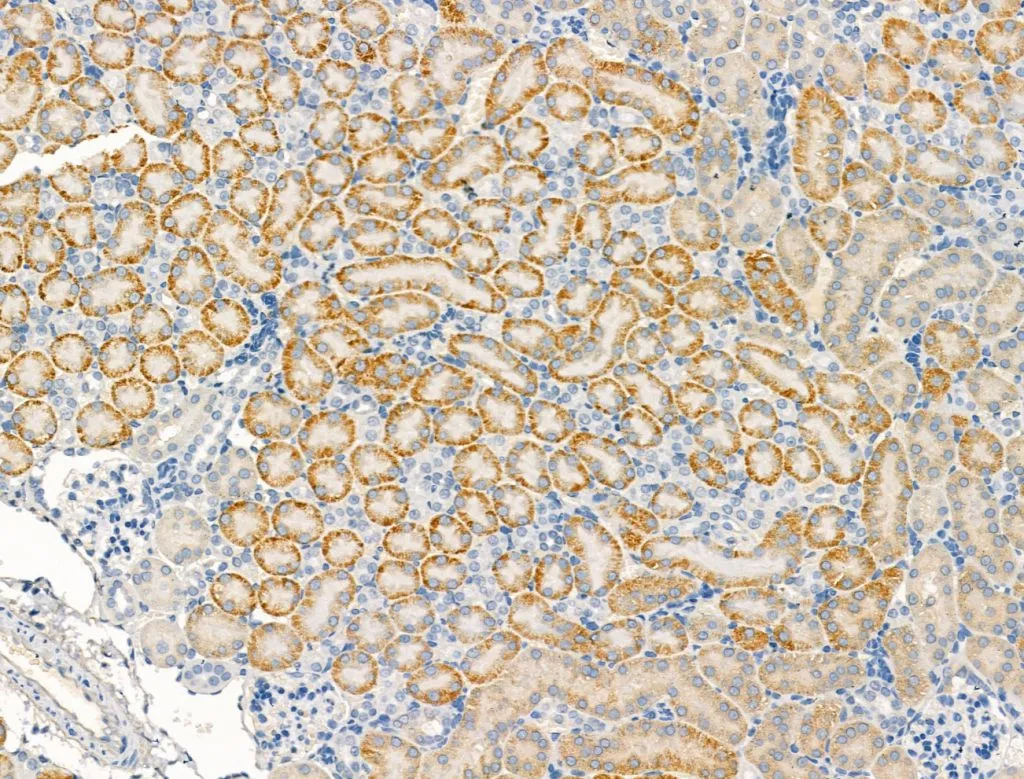 IHC-P analysis of mouse kidney tissue using GTX04112 Trek1 antibody. Antigen retrieval : Heat mediated antigen retrieval step in citrate buffer Dilution : 1:100 IHC-P analysis of mouse kidney tissue using GTX04112 Trek1 antibody. Antigen retrieval : Heat mediated antigen retrieval step in citrate buffer Dilution : 1:100