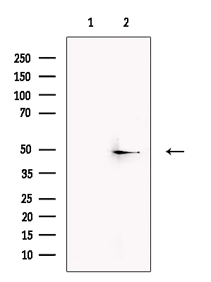WB analysis of human brain tissue lysates using GTX04112 Trek1 antibody. The lane on the left was treated with blocking peptide.