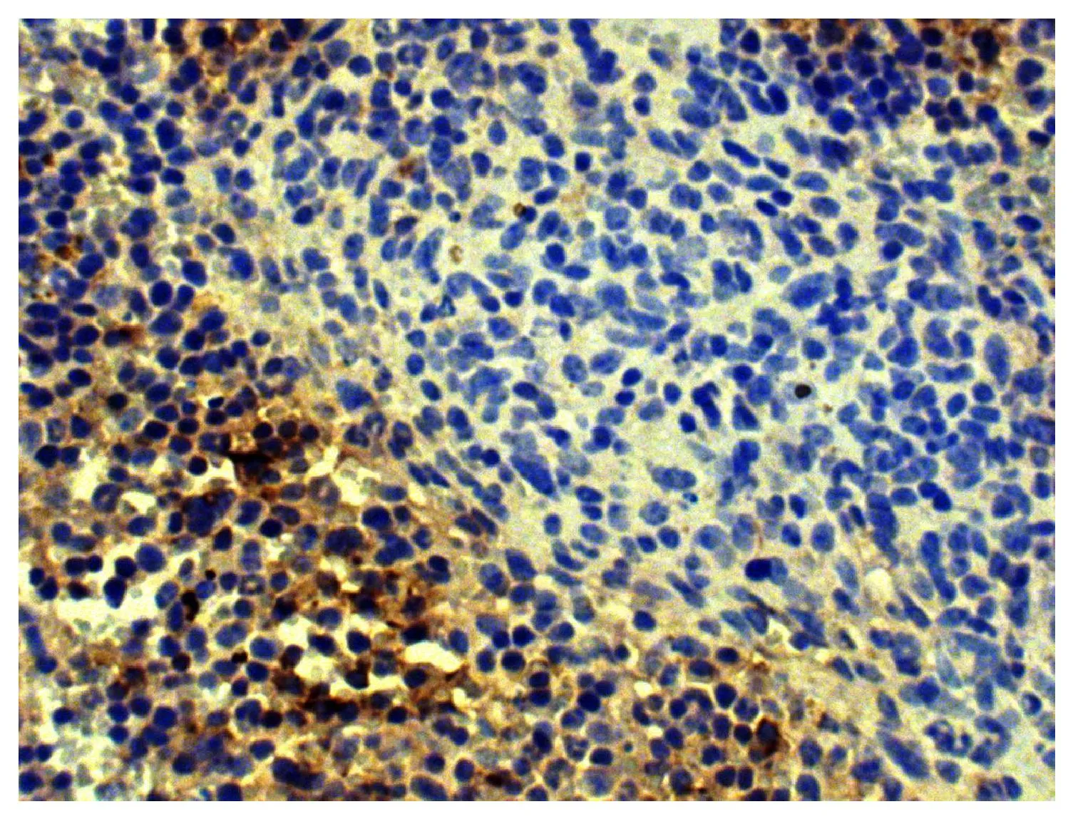 IHC-P analysis of mouse spleen tissue using GTX04202-01 Goat Anti-Mouse kappa light chain antibody, F(ab)2 fragment, pre-adsorbed (HRP). IHC-P analysis of mouse spleen tissue using GTX04202-01 Goat Anti-Mouse kappa light chain antibody, F(ab)2 fragment, pre-adsorbed (HRP).