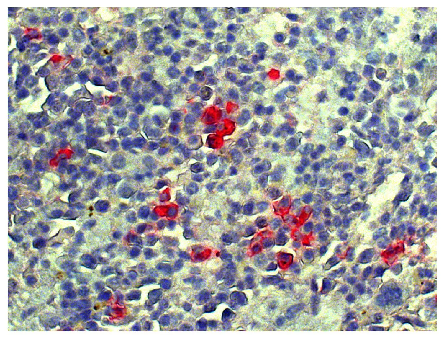 IHC-P analysis of mouse spleen tissue using GTX04203 Goat Anti-Mouse lambda light chain antibody, pre-adsorbed followed by Donkey Anti-Goat IgG antibody, pre-absorbed (AP). IHC-P analysis of mouse spleen tissue using GTX04203 Goat Anti-Mouse lambda light chain antibody, pre-adsorbed followed by Donkey Anti-Goat IgG antibody, pre-absorbed (AP).