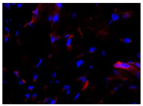 IHC-Fr analysis of horse sacroid tissue using MHC I antibody followed by GTX04210-25 Goat Anti-Mouse IgG2a (Heavy chain) antibody, pre-adsorbed (TRITC).