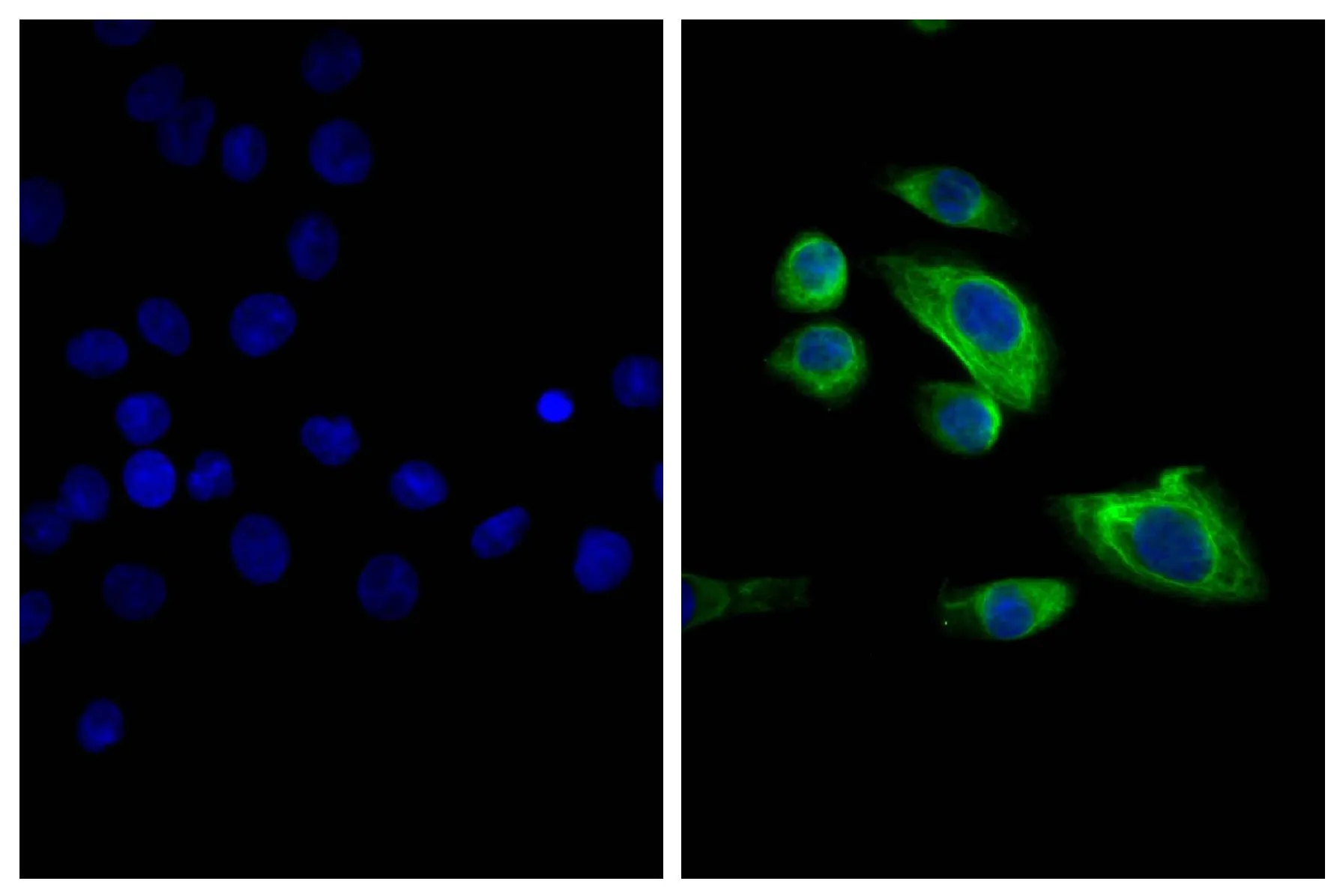 ICC/IF analysis of MIA PaCa-2 cells using Mouse Anti-Cytokeratin 18 antibody followed by GTX04216-06 Goat Anti-Mouse IgG2b (Heavy chain) antibody, F(ab)2 fragment, pre-adsorbed (FITC).