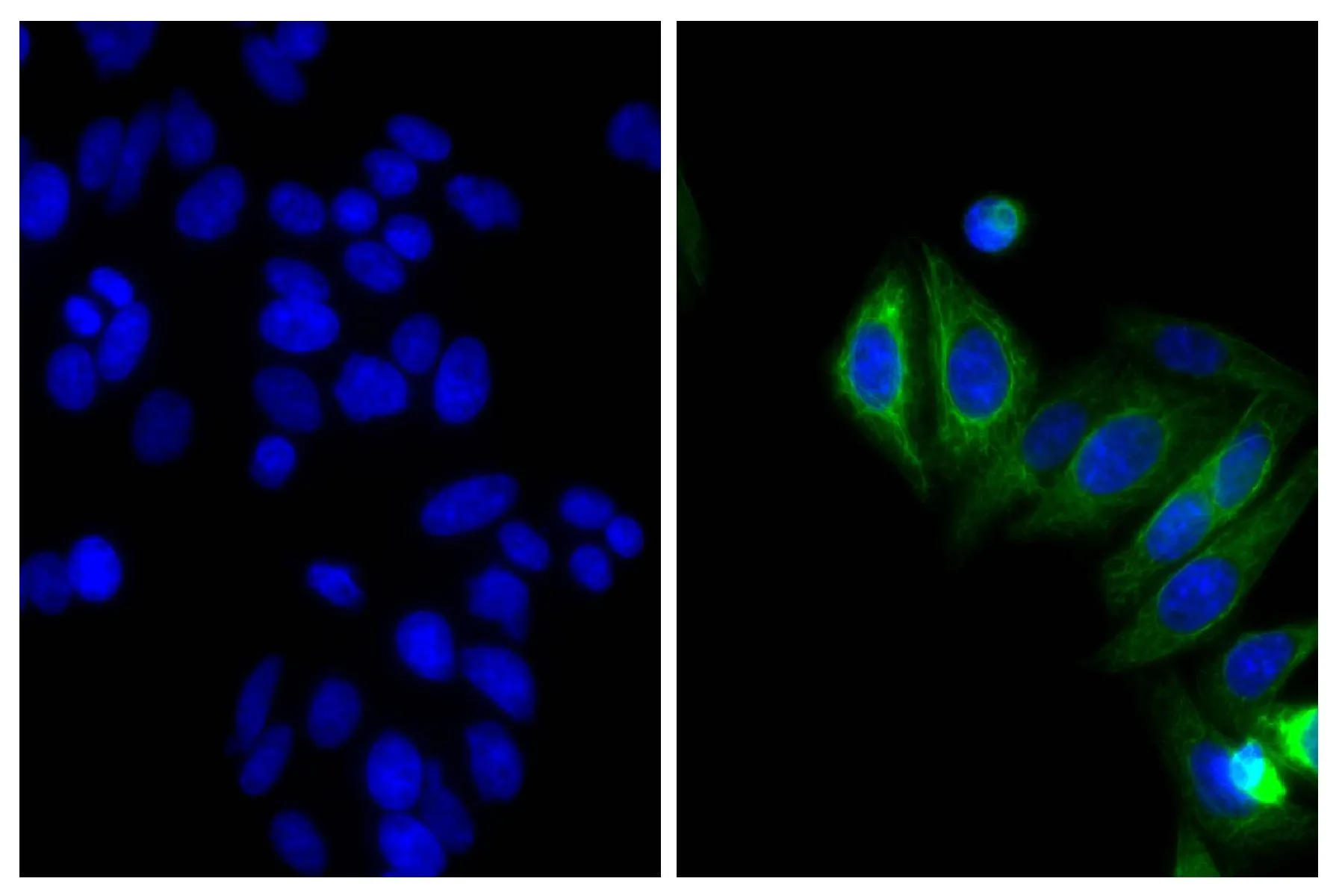 ICC/IF analysis of HEp-2 cells using Mouse Anti-Cytokeratin 18 antibody followed by GTX04217-02 Goat Anti-Mouse IgG2b (Heavy chain) antibody, pre-adsorbed (Biotin) and Streptavidin (CY2).