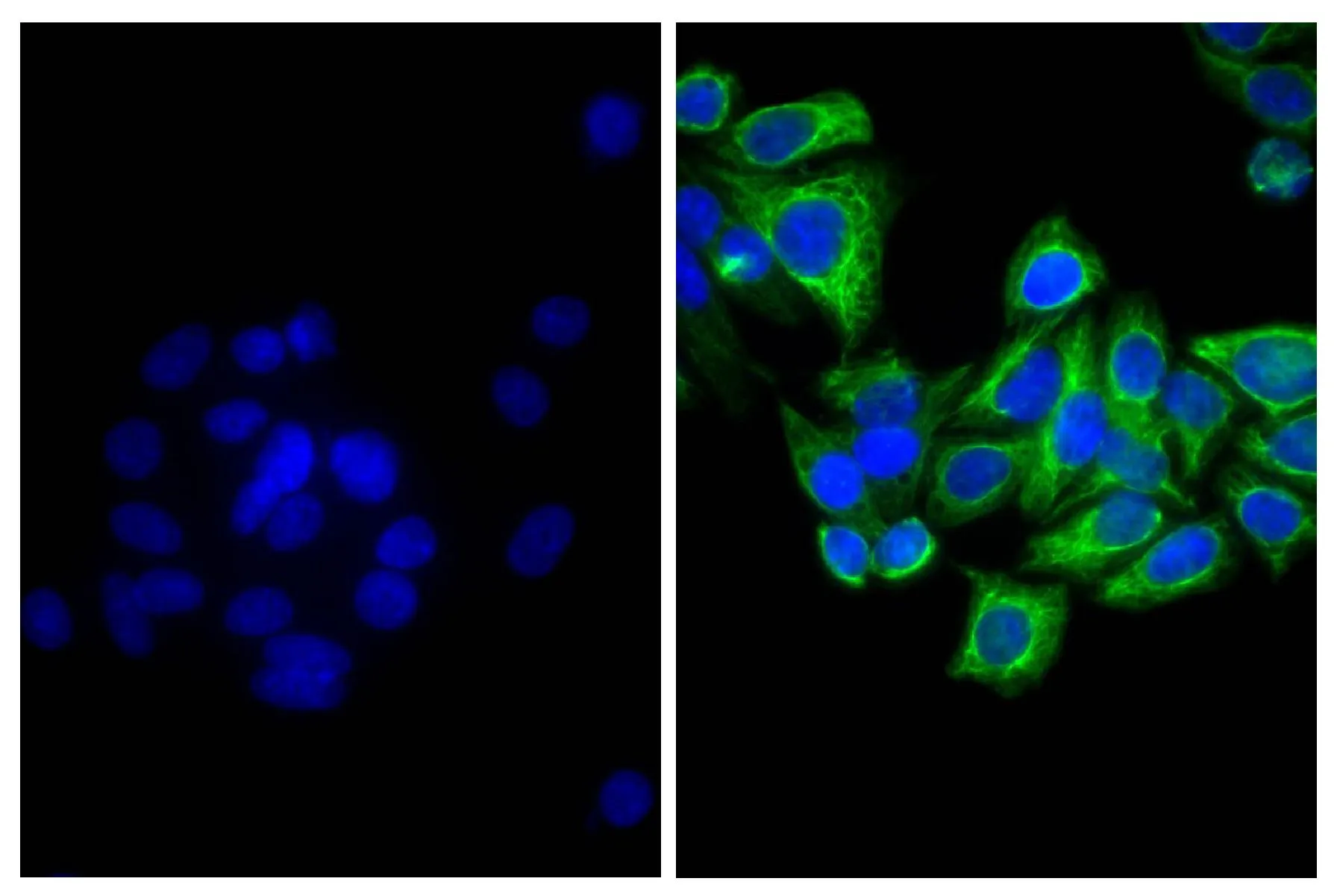 ICC/IF analysis of HEp-2 cells using Mouse Anti-Cytokeratin 18 antibody followed by GTX04217-06 Goat Anti-Mouse IgG2b (Heavy chain) antibody, pre-adsorbed (FITC).