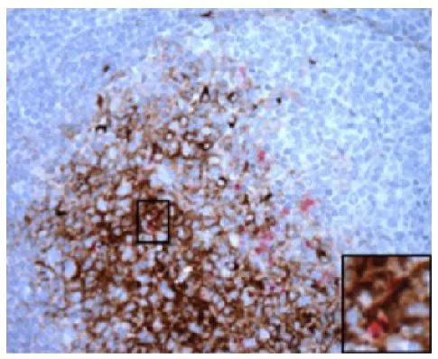 IHC-P analysis of scrapie-infected sheep retropharyngeal lymph node tissue using Follicular Dendritic cell antibody followed by GTX04225-01 Rat Anti-Mouse IgM antibody [SB73a] (HRP).