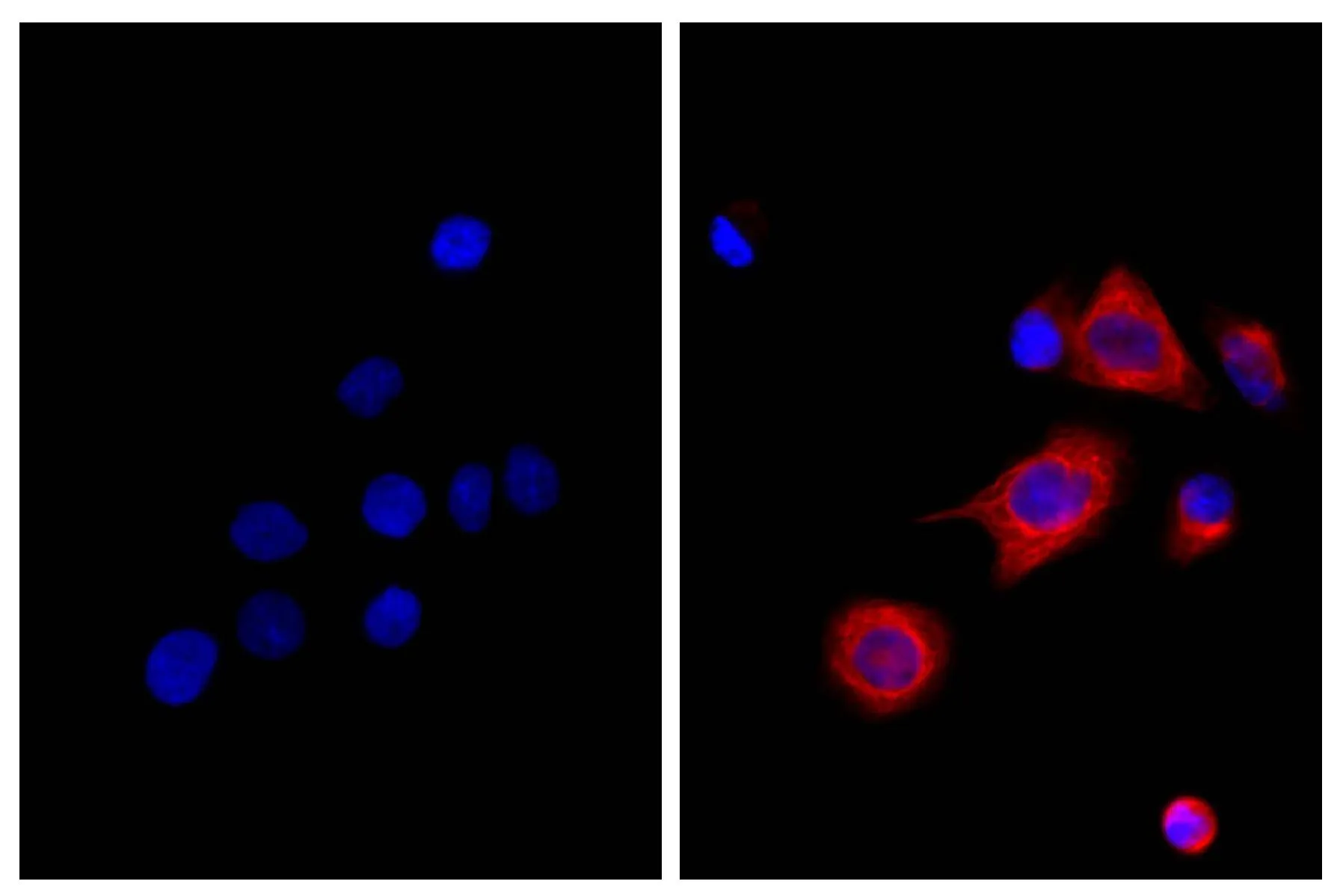 ICC/IF analysis of MIA PaCa-2 cells using Mouse Anti-Cytokeratin 18 antibody followed by GTX04231-02 Rat Anti-Mouse IgG2b antibody [SB74g] (Biotin) and Streptavidin (CY3).