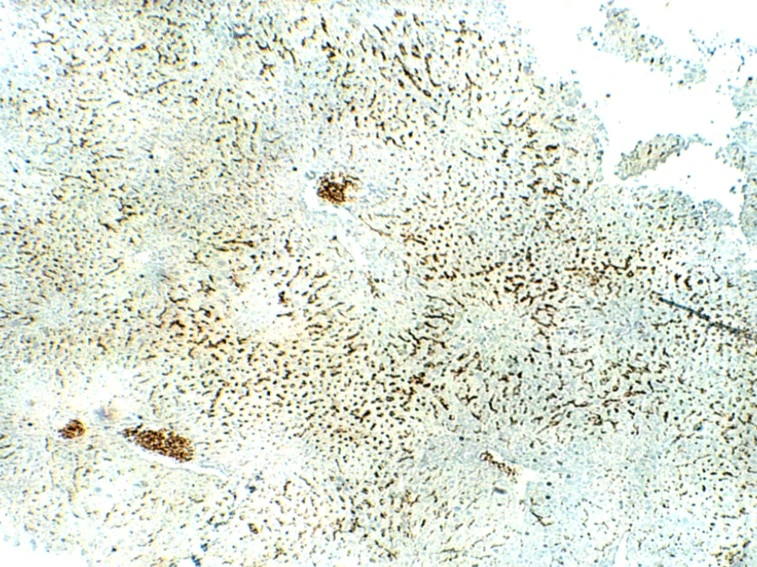 IHC-P analysis of mouse liver tissue using GTX04251 SLC31A1 / CTR1 antibody. Dilution : 1:50 IHC-P analysis of mouse liver tissue using GTX04251 SLC31A1 / CTR1 antibody. Dilution : 1:50