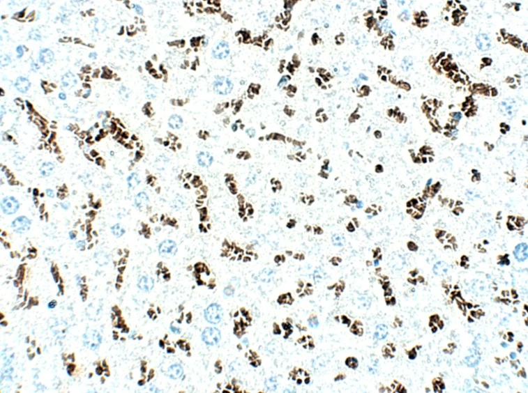 IHC-P analysis of mouse liver tissue using GTX04251 SLC31A1 / CTR1 antibody. Dilution : 1:50