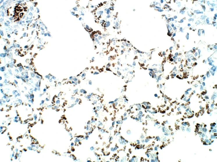 IHC-P analysis of mouse lung tissue using GTX04251 SLC31A1 / CTR1 antibody. Dilution : 1:50