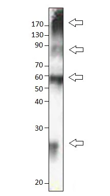 WB analysis of CTR1 protein lysates using GTX04251 SLC31A1 / CTR1 antibody. Arrows label monomeric, dimeric, and multimeric human CTR1. Dilution : 1:1000