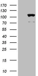 WB analysis of 293T cells transfected with human CIP2A using GTX04253 CIP2A antibody [OTI9E6]. Lane 1 : 293T cells transfected with control vector Lane 2 : 293T cells transfected with human CIP2A Loading : 5 microg Dilution : 1:2000