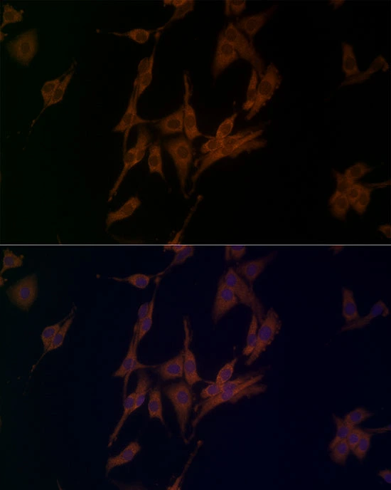 ICC/IF analysis of PC-12 cells using GTX04254 NALP1 antibody. Dilution : 1:50 Blue : DAPI ICC/IF analysis of PC-12 cells using GTX04254 NALP1 antibody. Dilution : 1:50 Blue : DAPI