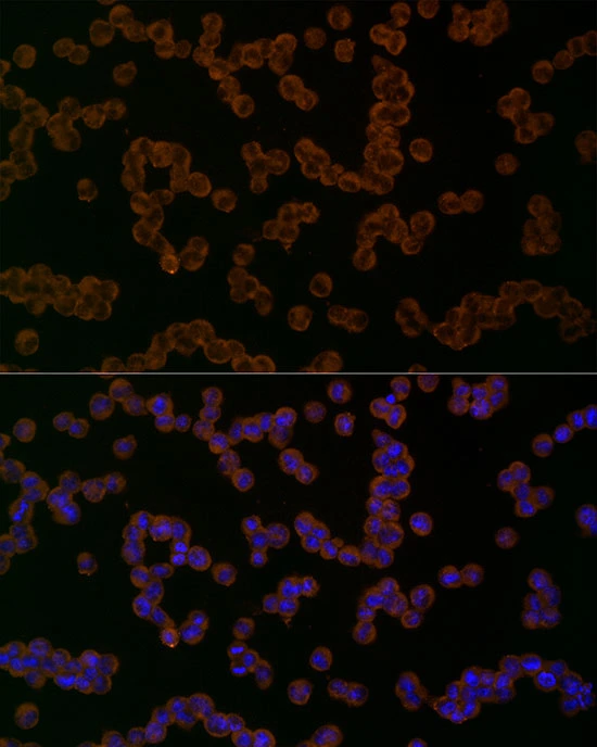 ICC/IF analysis of K562 cells using GTX04254 NALP1 antibody. Dilution : 1:50 Blue : DAPI
