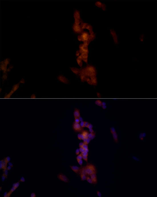 ICC/IF analysis of SH-SY5Y cells using GTX04254 NALP1 antibody. Dilution : 1:50 Blue : DAPI