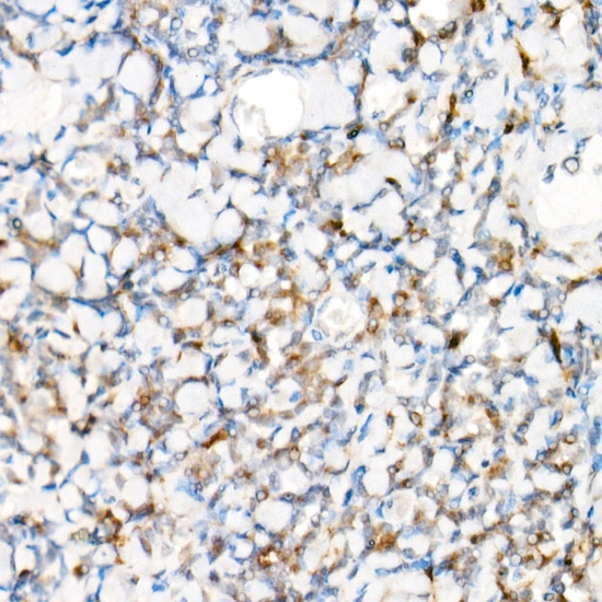 IHC-P analysis of human tonsil tissue using GTX04254 NALP1 antibody. Antigen retrieval : 10 mM citrate buffer (pH 6) Dilution : 1:50