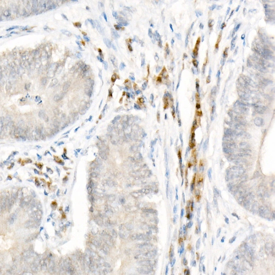 IHC-P analysis of human colon tissue using GTX04254 NALP1 antibody. Antigen retrieval : 10 mM citrate buffer (pH 6) Dilution : 1:50