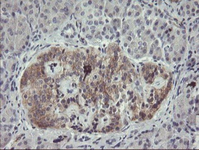 IHC-P analysis of human pancreas tissue using GTX04263 EIF5A2 antibody [OTI6G7]. Antigen retrieval : Heat-induced epitope retrieval by 10mM citric buffer, pH 6.0, 100oC for 10min