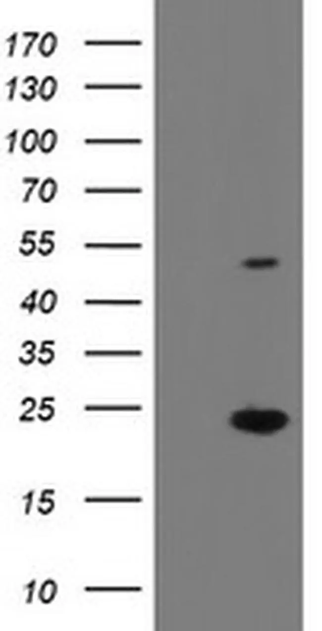 WB analysis of 293T cells transfected with human EIF5A2 using GTX04263 EIF5A2 antibody [OTI6G7]. Lane 1 : 293T cells transfected with control vector Lane 2 : 293T cells transfected with human EIF5A2 Loading : 5 microg