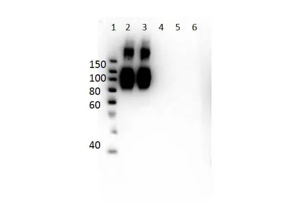 WB analysis of various samples using GTX04267 Hemoglobin beta antibody [14G2.G11.F11]. Lane 1 : Protein Ladder Lane 2 : HbA peptide conjugated to BSA Lane 3 : HbA-2 peptide conjugated to BSA Lane 4 : HbC peptide conjugated to BSA Lane 5 : HbF peptide conjugated to BSA Lane 6 : HbS peptide conjugated to BSA Loading : 50 ng Dilution : 1 microg/mL