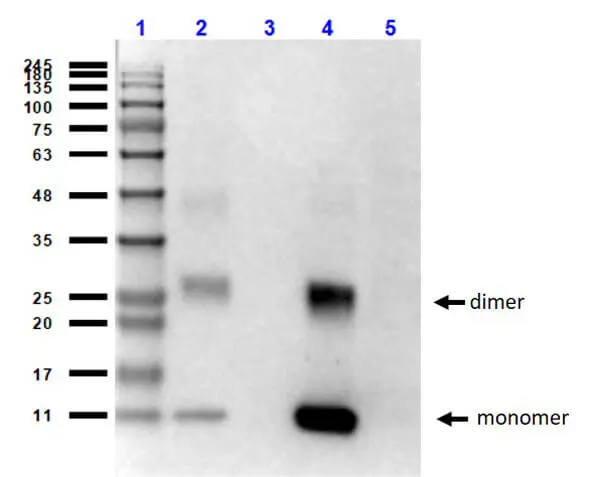 WB analysis of various samples using GTX04267 Hemoglobin beta antibody [14G2.G11.F11]. Lane 1 : Protein ladder Lane 2 : Human HbA (0.1 microg) Lane 3 : Human HbS (0.1 microg) Lane 4 : Human heart whole cell lysate (2 microg) Lane 5 : HeLa whole cell lysate (10 microg) Dilution : 1 microg/mL