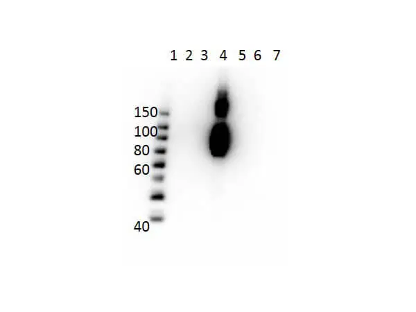 WB analysis of various samples using GTX04269 Hemoglobin beta C antibody [15C2.C11.F2.G11]. Lane 1 : Protein ladder Lane 2 : HbA peptide conjugated to BSA Lane 3 : HbA-2 peptide conjugated to BSA Lane 4 : HbC peptide conjugated to BSA Lane 5 : HbF peptide conjugated to BSA Lane 6 : HbS peptide conjugated to BSA Lane 7 : BSA Loading : 50 ng Dilution : 1 microg/mL