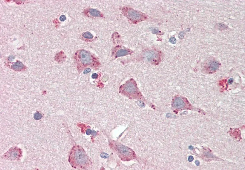 IHC-P analysis of human cortex tissue using GTX00831 BMP1 antibody. Antigen retrieval : Steamed antigen retrieval with citrate buffer pH 6 Dilution : 5microg/ml