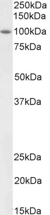WB analysis of rat heart tissue lysate (35microg protein in RIPA buffer) using GTX00831 BMP1 antibody. Dilution : 2microg/ml