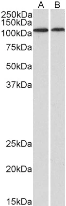 WB analysis of human heart (A) and kidney (B) tissue lysates (35microg protein in RIPA buffer) using GTX00831 BMP1 antibody. Dilution : 1microg/ml
