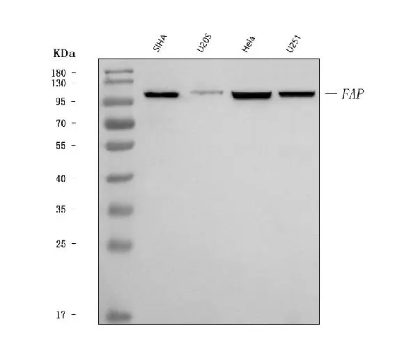 WB analysis of various cell lysates using GTX04307 FAP antibody. Loading : 30 microg Dilution : 0.25 microg/mL
