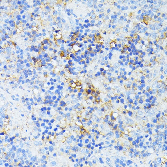 IHC-P analysis of rat spleen tissue using GTX04308 TP53I11 antibody. Dilution : 1:100 Antigen retrieval : Perform microwave antigen retrieval with 10 mM PBS buffer pH 7.2