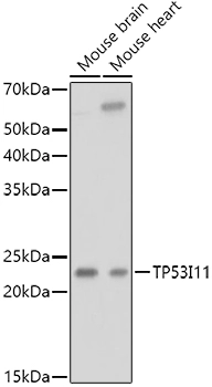 WB analysis of various sample lysates using GTX04308 TP53I11 antibody. Dilution : 1:1000 Loading : 25microg per lane