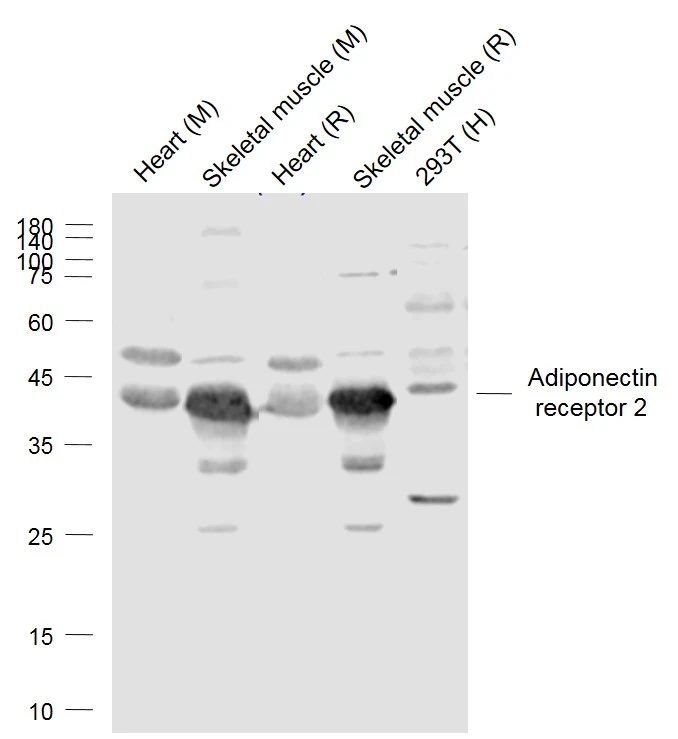 WB analysis of various cell lysates using GTX04314 Adiponectin Receptor 2 antibody. Lane 1 : Mouse heart tissue lysate Lane 2 : Mouse skeletal muscle tissue lysate Lane 3 : Rat heart tissue lysate Lane 4 : Rat Skeletal muscle tissue lysate Lane 5 : 293T whole cell lysate Dilution : 1:1000