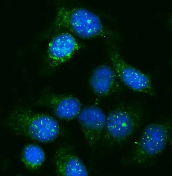 ICC/IF analysis of HeLa cells using GTX04318 GNAL antibody. Green : Primary antibody Blue : DAPI Antigen retrieval : IHC enzyme antigen retrieval reagent for 15 mins Dilution : 5 microg/mL ICC/IF analysis of HeLa cells using GTX04318 GNAL antibody. Green : Primary antibody Blue : DAPI Antigen retrieval : IHC enzyme antigen retrieval reagent for 15 mins Dilution : 5 microg/mL