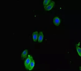 ICC/IF analysis of HepG2 cells using GTX04320 SMOC1 antibody. Dilution : 1:100 ICC/IF analysis of HepG2 cells using GTX04320 SMOC1 antibody. Dilution : 1:100