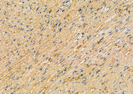 IHC-P analysis of rat heart tissue using GTX04322 WNK3 antibody. Antigen retrieval : Heat mediated antigen retrieval step in citrate buffer was performed. Dilution : 1:100