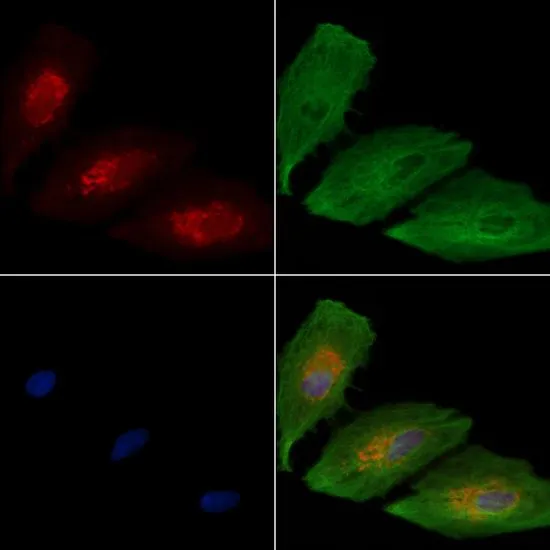 WB analysis of mouse brain tissue lysate using GTX04322 WNK3 antibody. The lane on the left was treated with the antigen-specific peptide.