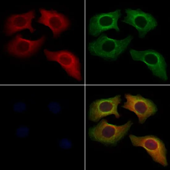ICC/IF analysis of PFA fixed HeLa cells using GTX04323 Coagulation factor III/Tissue Factor antibody. Red : Primary antibody Green : beta tubulin Permeabilization : 0.1% Triton X-100 Dilution : 1:200 ICC/IF analysis of PFA fixed HeLa cells using GTX04323 Coagulation factor III/Tissue Factor antibody. Red : Primary antibody Green : beta tubulin Permeabilization : 0.1% Triton X-100 Dilution : 1:200