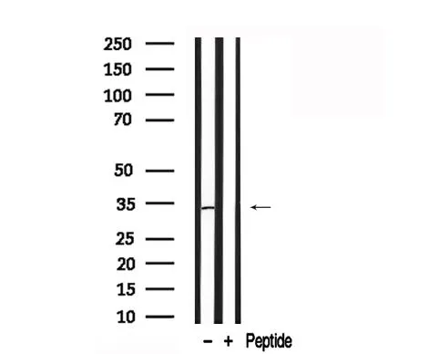 WB analysis of MDA-MB-231 whole cell lysate using GTX04323 Coagulation factor III/Tissue Factor antibody. The lane on the left was treated with blocking peptide.