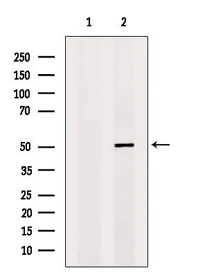 WB analysis of MDA-MB-231 whole cell lysate using GTX04323 Coagulation factor III/Tissue Factor antibody. The lane on the left was treated with blocking peptide.