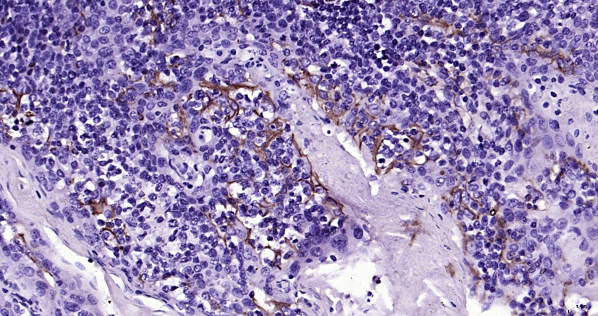 IHC-P analysis of human tonsil tissue using GTX04325 CD31 antibody. Antigen retrieval : Boiling in sodium citrate buffer (pH6.0) for 15min Dilution : 1:200