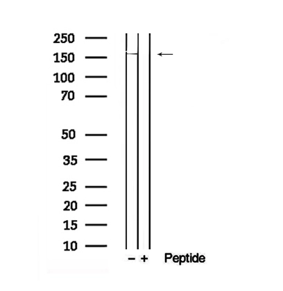 WB analysis of HeLa cell lysate using GTX04327 DEPDC5 (phospho Ser1002) antibody. The lane on the right was treated with blocking peptide.