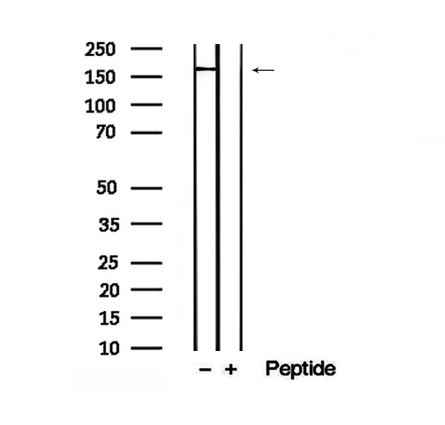 WB analysis of HeLa cell lysate using GTX04329 DEPDC5 (phospho Thr1531) antibody. The lane on the right was treated with blocking peptide.