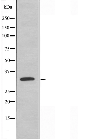WB analysis of COS7 whole cell lysate using GTX04335 ACER2 antibody. WB analysis of COS7 whole cell lysate using GTX04335 ACER2 antibody.