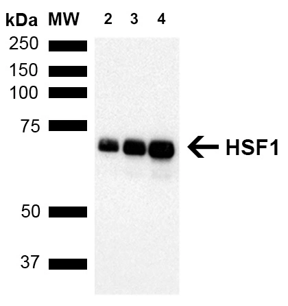 WB analysis of MCF7 whole cell lysates using GTX04341 HSF1 antibody [10H8]. Loading : Lane 2 : 5 microg Lane 3 : 10 microg Lane 4 : 20 microg Dilution : 1:1000