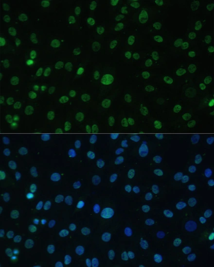 ICC/IF analysis of C6 cells using GTX04342 HSF1 antibody. Green : Primary antibody Blue : DAPI Dilution : 1:100