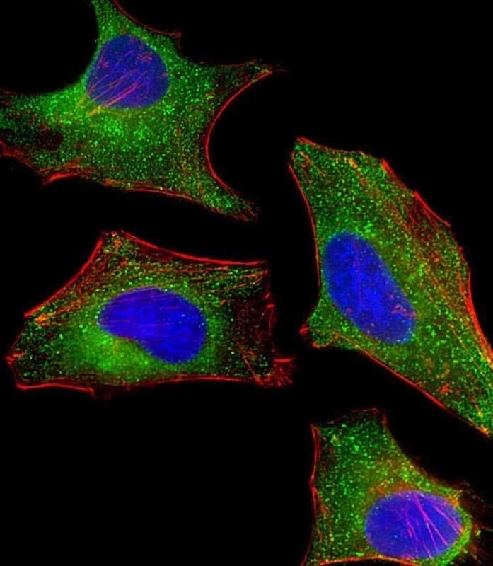 ICC/IF analysis of 4% PFA fixed HeLa cells using GTX04343 DHCR7 antibody. Green : Primary antibody Blue : DAPI Red : Phalloidin Dilution : 1:25