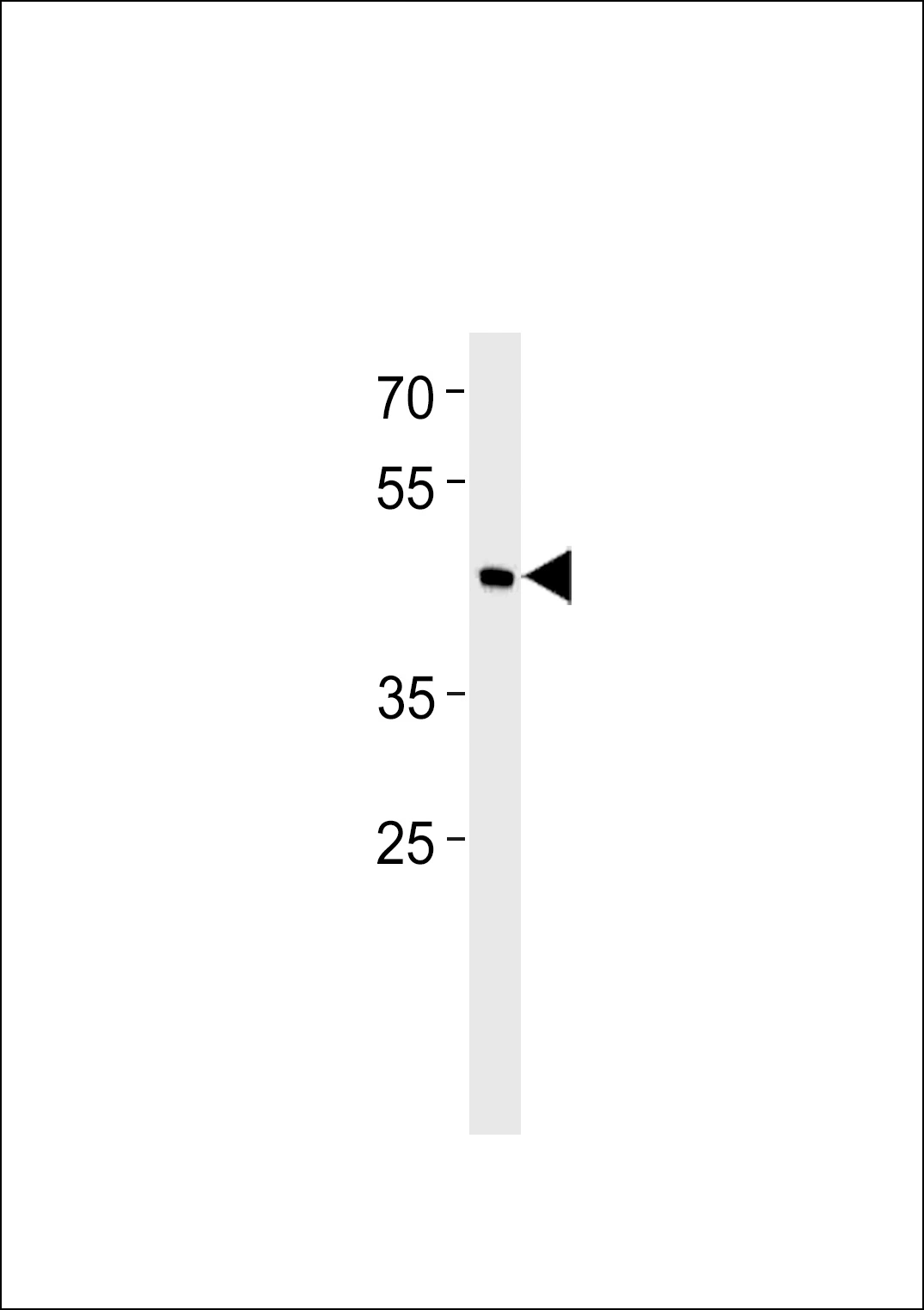 WB analysis of RD whole cell lysates using GTX04346 SHARP1 antibody. Loading : 35 microg